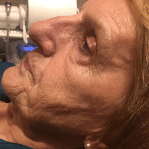 Buy Dual Injector Pro+ at 4T Medical