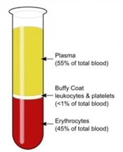Plasma PRP
