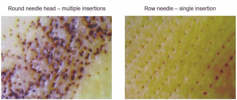 SkinrePen Microneedling skin demo