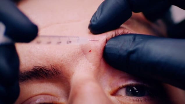 Specialist Consumables for Advanced Injectable Treatments