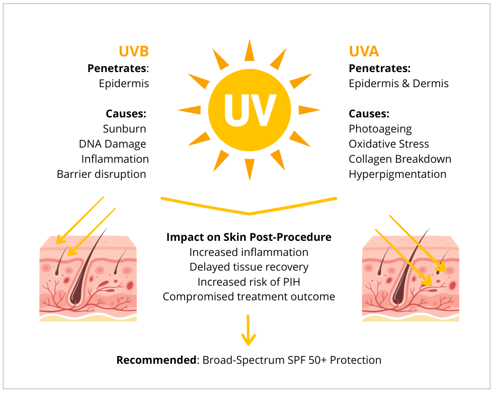 UVA and UVB explained